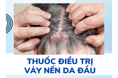 Thông tin thuốc trị vảy nến da đầu bạn cần phải biết